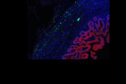 Waves of combined nerve and intestine stem cells